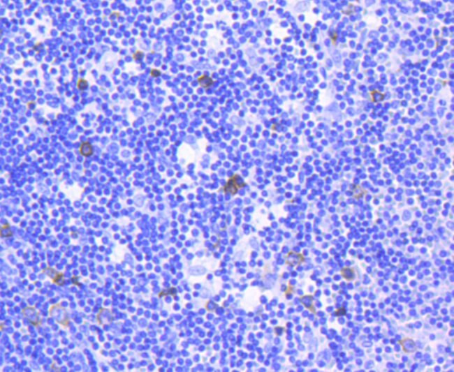 TACC3 Antibody in Immunohistochemistry (Paraffin) (IHC (P))