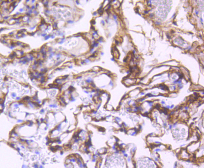 CD140b (PDGFRB) Antibody in Immunohistochemistry (Paraffin) (IHC (P))