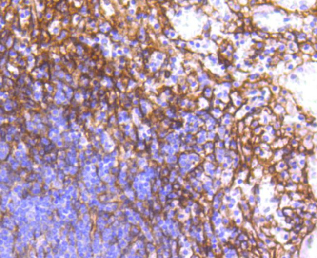 CD140b (PDGFRB) Antibody in Immunohistochemistry (Paraffin) (IHC (P))