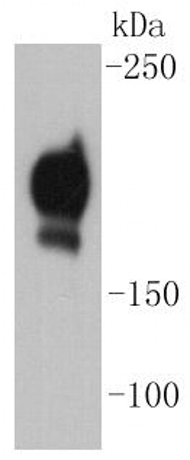 CD140b (PDGFRB) Antibody in Western Blot (WB)