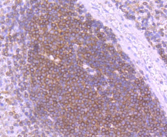 SHIP1 Antibody in Immunohistochemistry (Paraffin) (IHC (P))