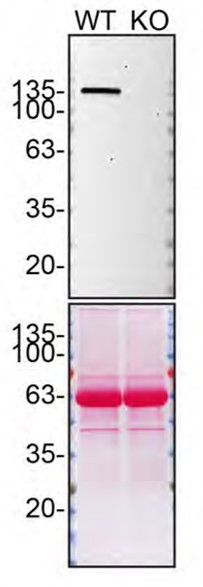 SHIP1 Antibody in Western Blot (WB)