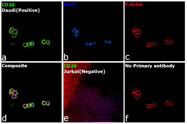 CD20 Antibody in Immunocytochemistry (ICC/IF)