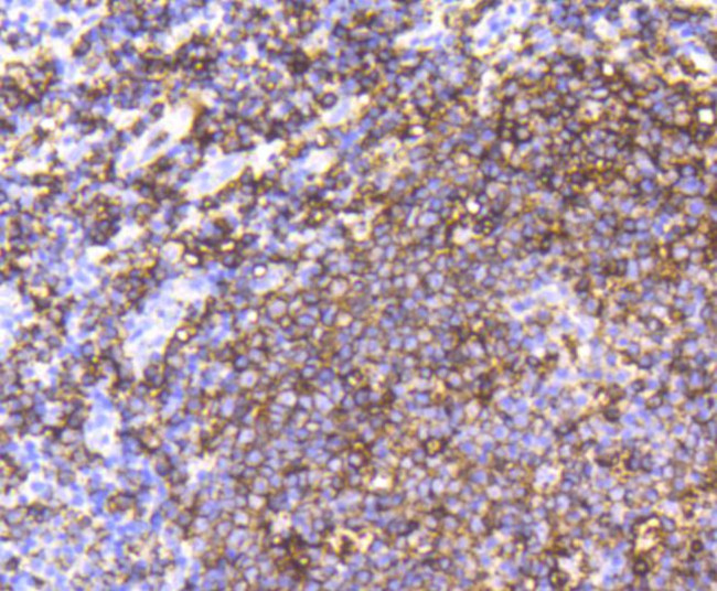 CD20 Antibody in Immunohistochemistry (Paraffin) (IHC (P))