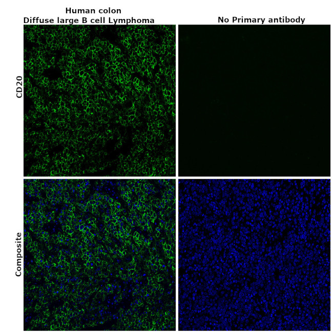 CD20 Antibody in Immunohistochemistry (Paraffin) (IHC (P))