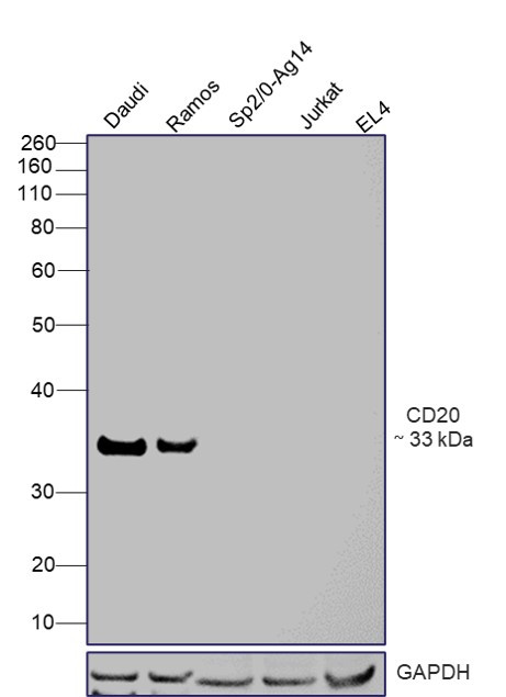 CD20 Antibody