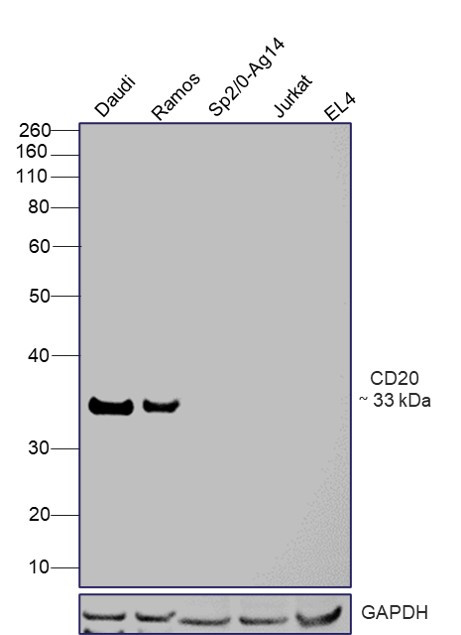 CD20 Antibody in Western Blot (WB)