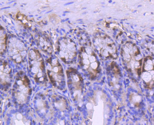 PCNA Antibody in Immunohistochemistry (Paraffin) (IHC (P))