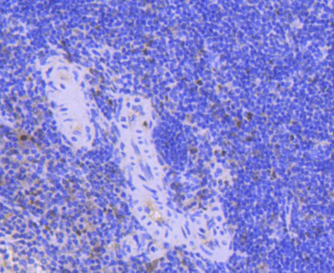 PCNA Antibody in Immunohistochemistry (Paraffin) (IHC (P))