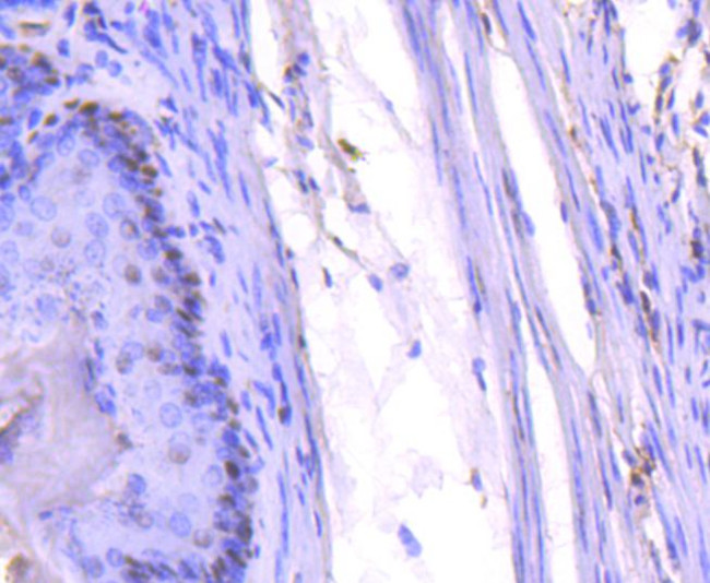 PCNA Antibody in Immunohistochemistry (Paraffin) (IHC (P))