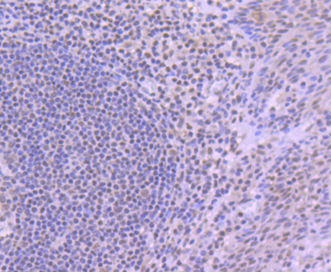 YY1 Antibody in Immunohistochemistry (Paraffin) (IHC (P))