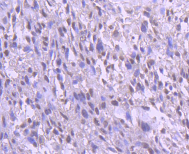 YY1 Antibody in Immunohistochemistry (Paraffin) (IHC (P))