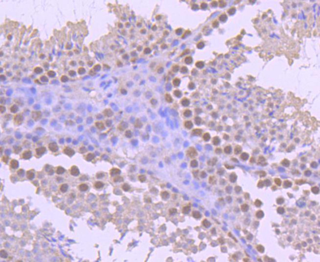 YY1 Antibody in Immunohistochemistry (Paraffin) (IHC (P))