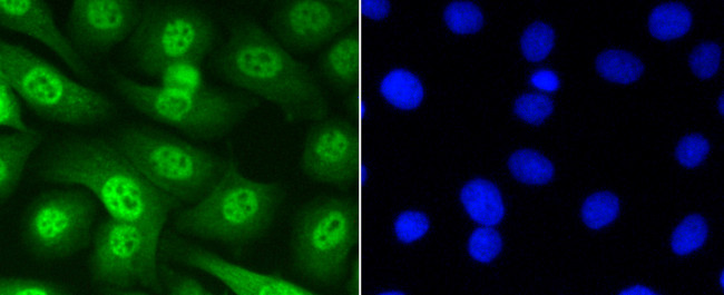 Phospho-Smad5 (Ser463,Ser465) Antibody in Immunocytochemistry (ICC/IF)