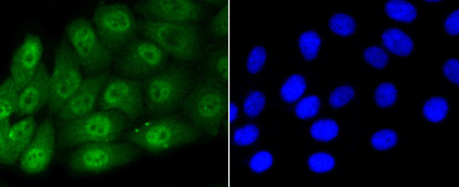 Phospho-Smad5 (Ser463,Ser465) Antibody in Immunocytochemistry (ICC/IF)