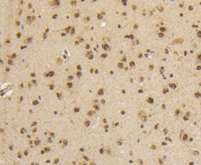 Phospho-Smad5 (Ser463,Ser465) Antibody in Immunohistochemistry (Paraffin) (IHC (P))