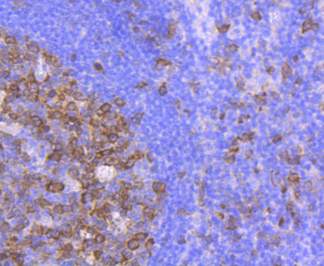 CDK1 Antibody in Immunohistochemistry (Paraffin) (IHC (P))