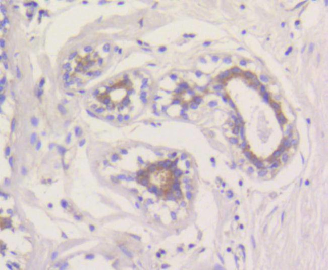 MCL-1 Antibody in Immunocytochemistry (ICC/IF)