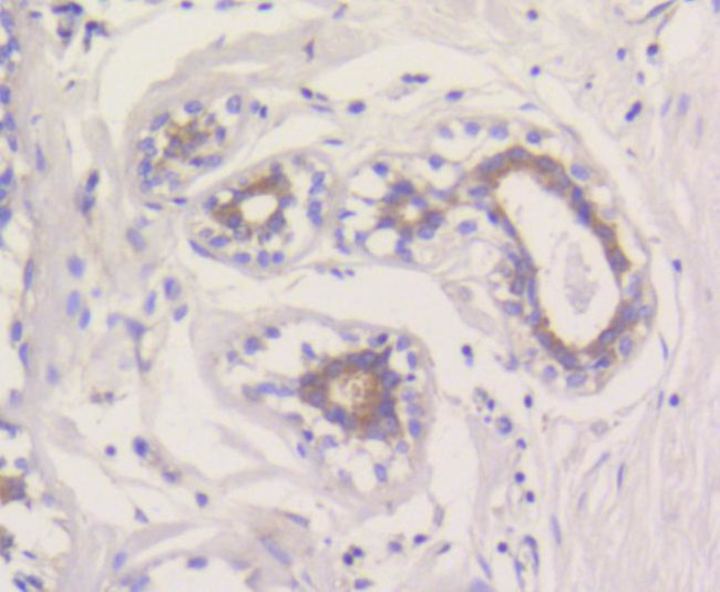 MCL-1 Antibody in Immunohistochemistry (Paraffin) (IHC (P))