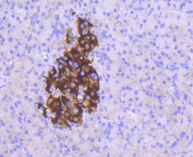 MCL-1 Antibody in Immunohistochemistry (Paraffin) (IHC (P))