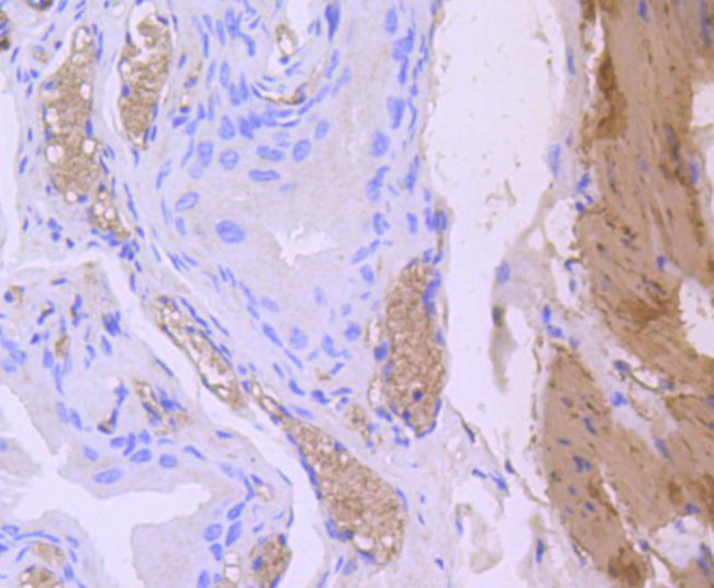 Calponin 1 Antibody in Immunohistochemistry (Paraffin) (IHC (P))