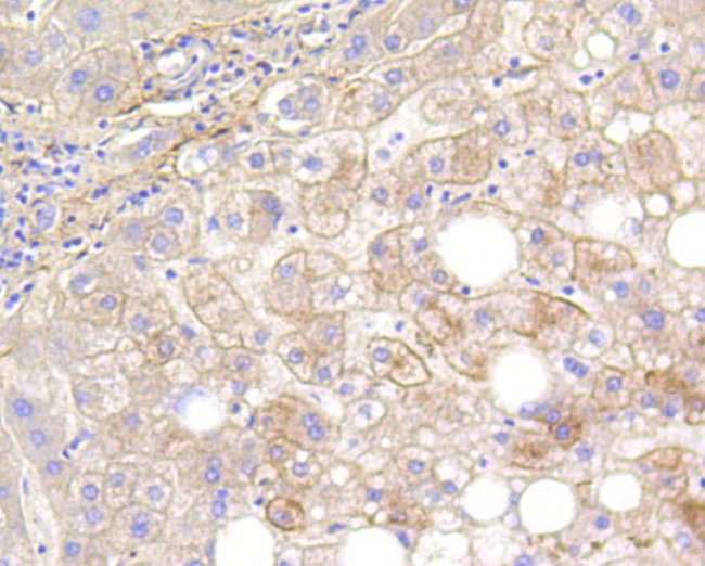 Calponin 1 Antibody in Immunohistochemistry (Paraffin) (IHC (P))