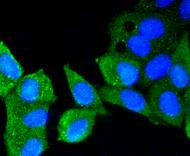 ATM Antibody in Immunocytochemistry (ICC/IF)