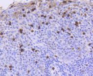 ATM Antibody in Immunohistochemistry (Paraffin) (IHC (P))