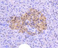 ATM Antibody in Immunohistochemistry (Paraffin) (IHC (P))