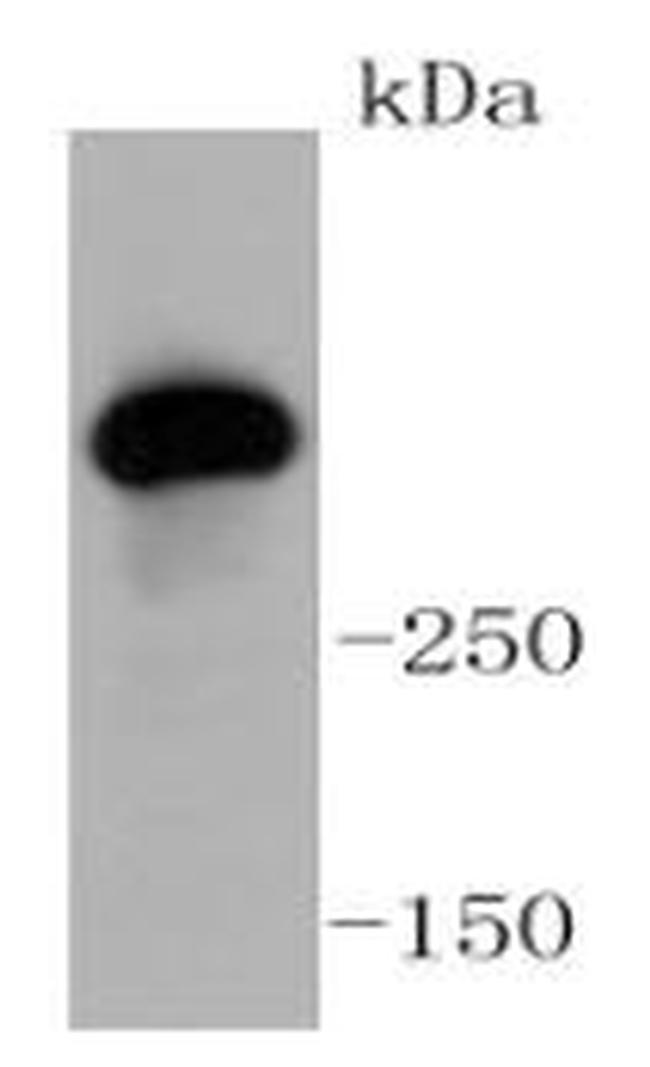 ATM Antibody in Western Blot (WB)