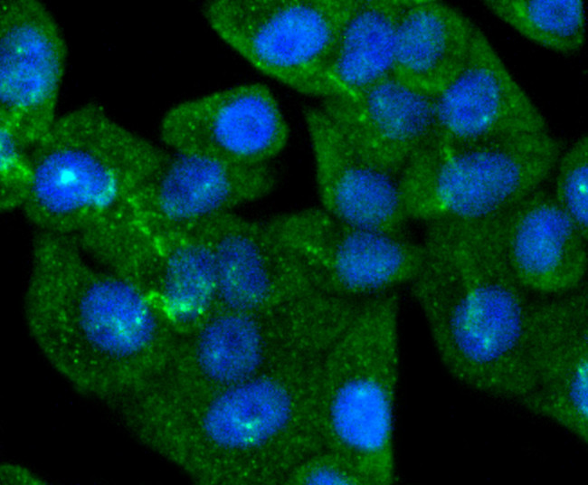 SMAD5 Antibody in Immunocytochemistry (ICC/IF)