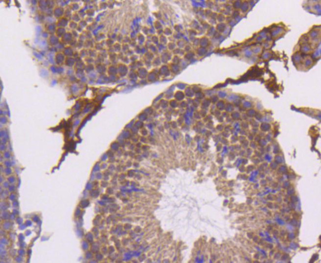 SMAD5 Antibody in Immunohistochemistry (Paraffin) (IHC (P))