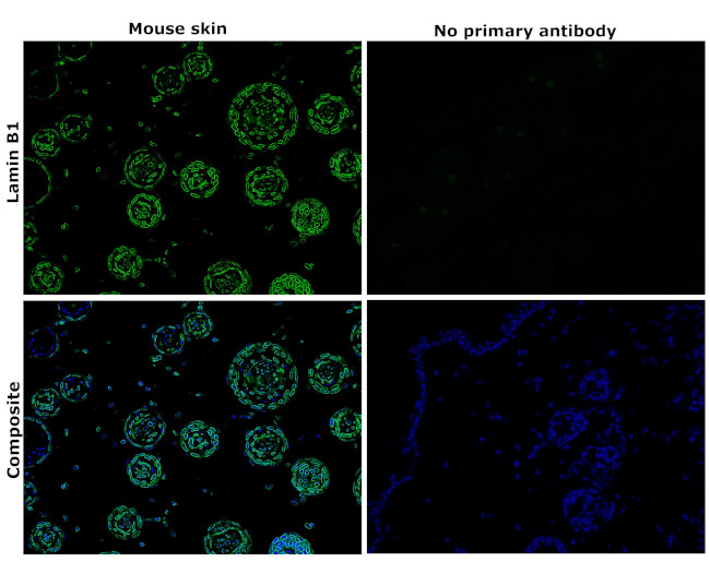 Lamin B1 Antibody in Immunohistochemistry (Paraffin) (IHC (P))