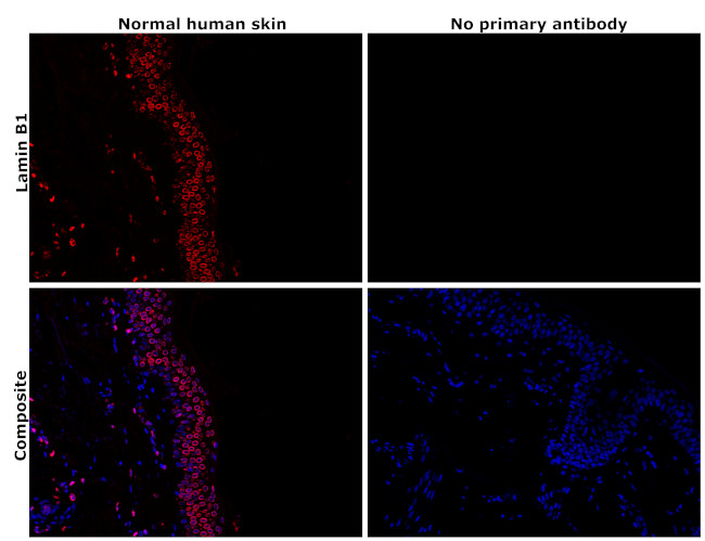 Lamin B1 Antibody in Immunohistochemistry (Paraffin) (IHC (P))