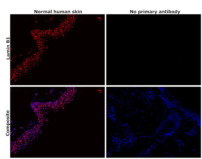 Lamin B1 Antibody in Immunohistochemistry (Paraffin) (IHC (P))