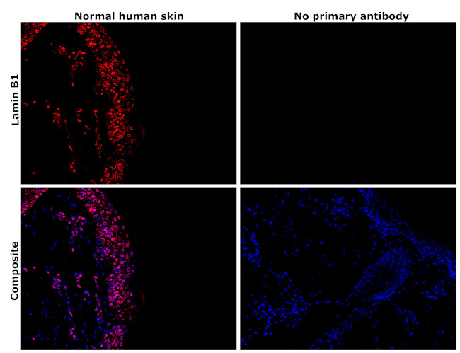 Lamin B1 Antibody in Immunohistochemistry (Paraffin) (IHC (P))