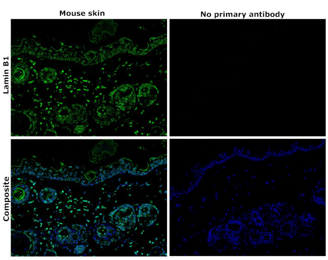 Lamin B1 Antibody in Immunohistochemistry (Paraffin) (IHC (P))