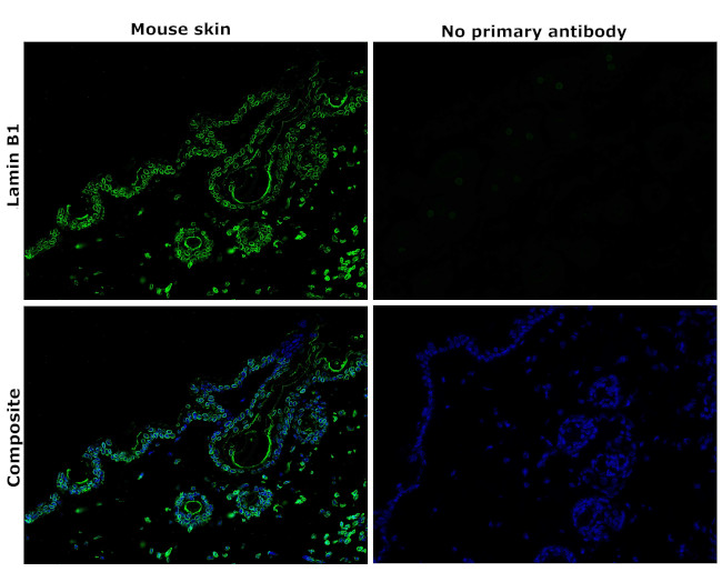 Lamin B1 Antibody in Immunohistochemistry (Paraffin) (IHC (P))