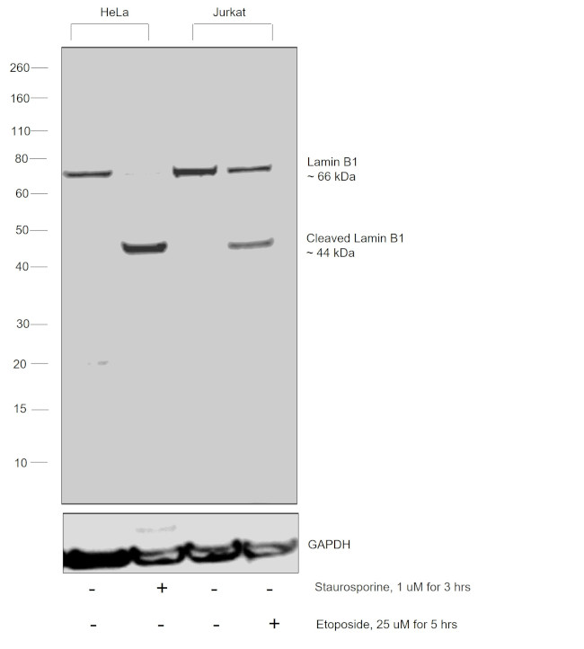 Lamin B1 Antibody in Western Blot (WB)