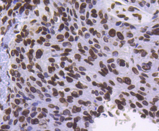 Lamin B1 Antibody in Immunohistochemistry (Paraffin) (IHC (P))