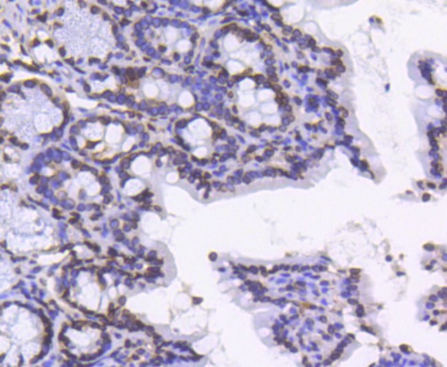 Lamin B1 Antibody in Immunohistochemistry (Paraffin) (IHC (P))