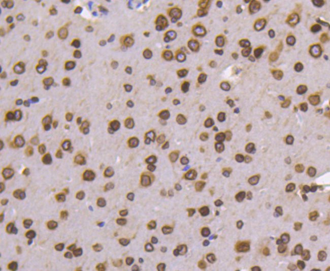 Lamin B1 Antibody in Immunohistochemistry (Paraffin) (IHC (P))