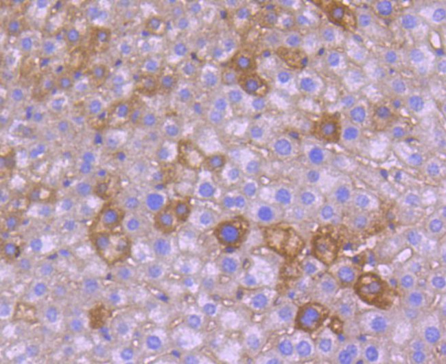 NGF Antibody in Immunohistochemistry (Paraffin) (IHC (P))