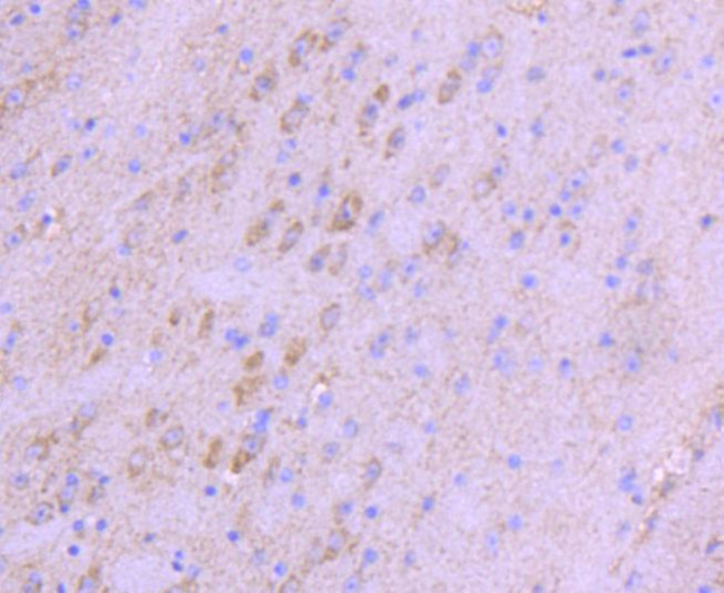 NGF Antibody in Immunohistochemistry (Paraffin) (IHC (P))