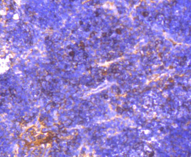 NGF Antibody in Immunohistochemistry (Paraffin) (IHC (P))