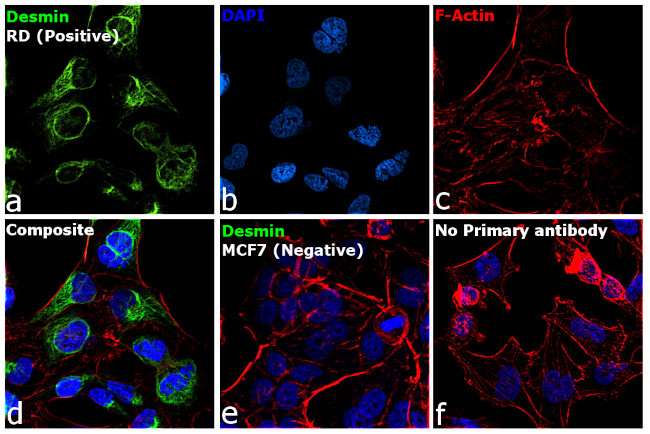 Desmin Antibody in Immunocytochemistry (ICC/IF)