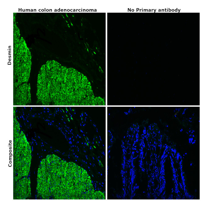 Desmin Antibody in Immunohistochemistry (Paraffin) (IHC (P))