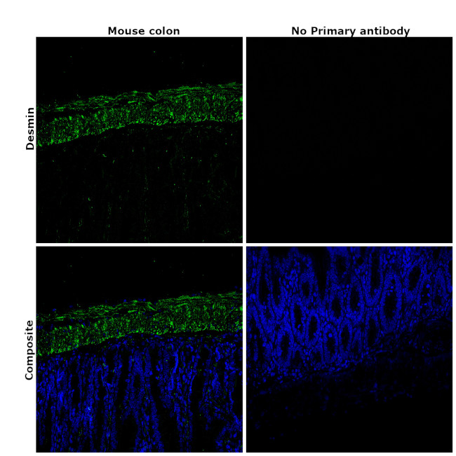 Desmin Antibody in Immunohistochemistry (Paraffin) (IHC (P))