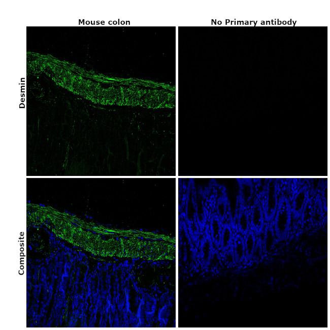 Desmin Antibody in Immunohistochemistry (Paraffin) (IHC (P))