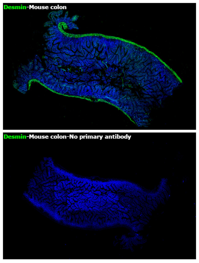 Desmin Antibody in Immunohistochemistry (Paraffin) (IHC (P))